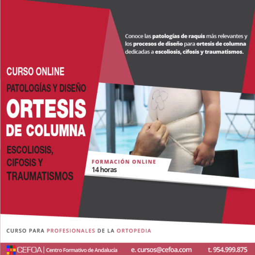 Patologías y diseño de ortesis de columna: escoliosis, cifosis y traumatismos